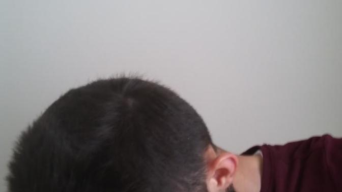 Saçım az mı çok takıntı yapıyorum bu konuyu?