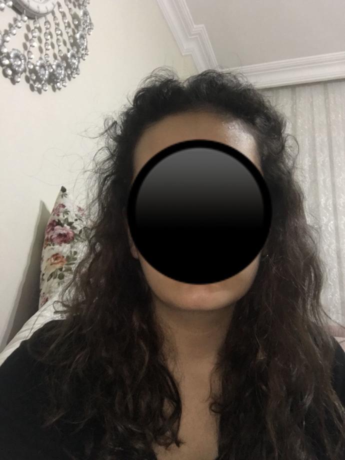 SAÇLARIM ÇOK ŞEKİLSİZ VE KABARIK ÇÖZÜM ÖNERİSİ OLAN VAR MI?