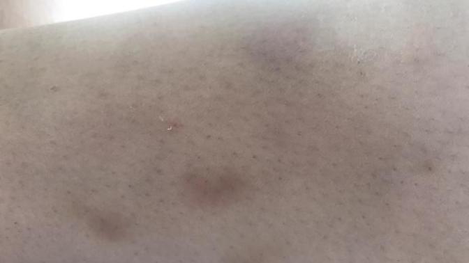 Kocam beni dovdu sizce ne yapmam gerek?