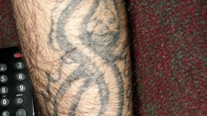 Dövmesi olup da sildiren var mı , süreç nasıl işliyor , fiyat aralığı nedir?