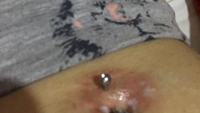 Göbeğimi deldirdim morardı detay?