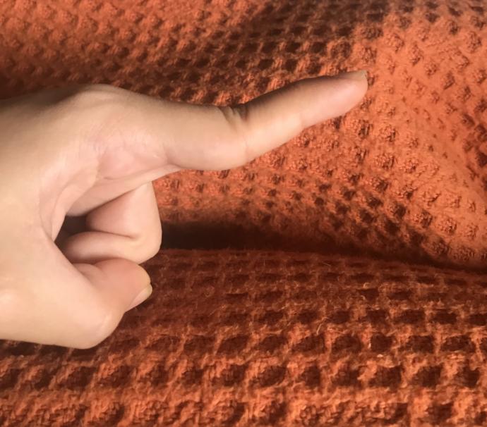 Parmağım bu sekilde eklemleri cok esnek cok kafaya takıyorum?