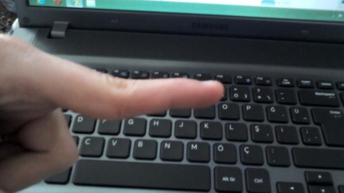 Parmağım bu sekilde eklemleri cok esnek cok kafaya takıyorum?