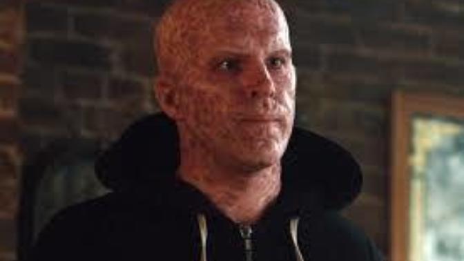 Sevgilinizin kanserden ölmesini mi yoksa deadpool gibi mutasyona uğraması mı yüzünün vücudunun iğrençleşmesi tercih edersiniz?