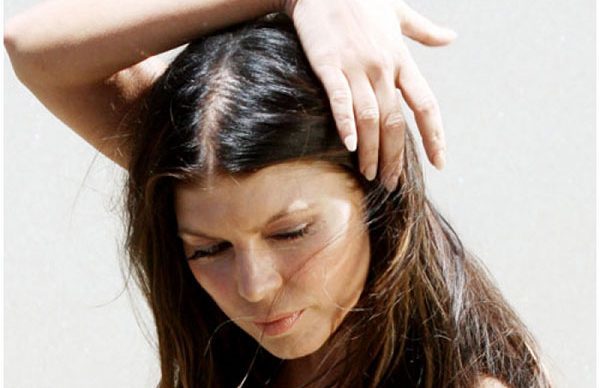 Seboreik dermatit nedir?