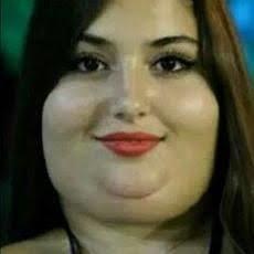 Yanakların şişkin olması kiloyla mı alakalıdır yoksa genetik mi?