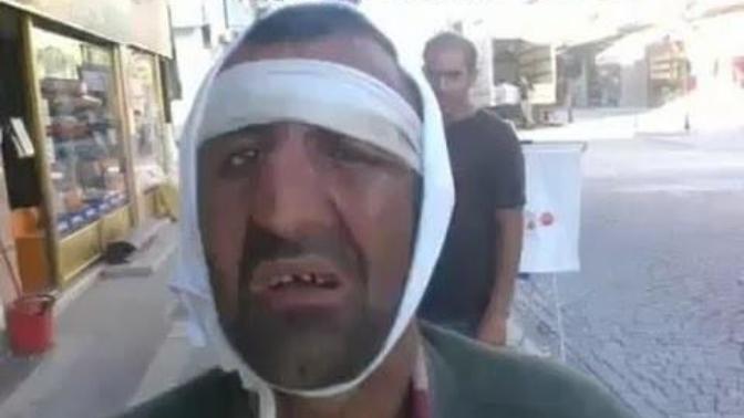 Dayak Yiyenlerin Söylediği Klişe Laflar Hangileri?