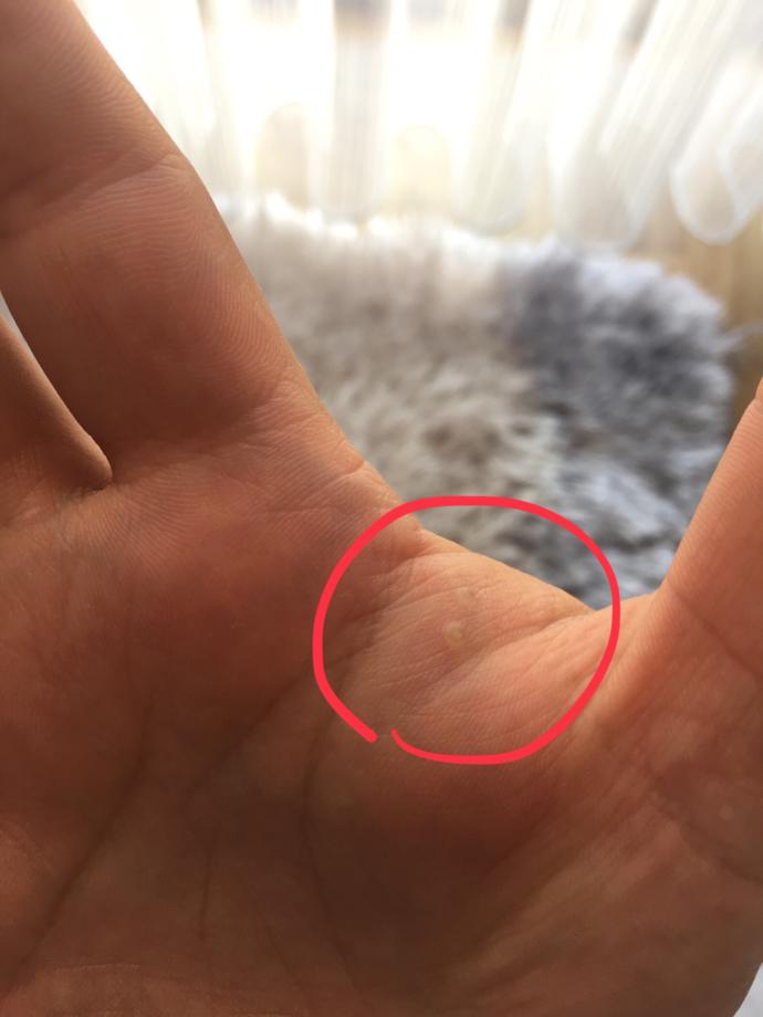 Elimde sürekli çıkan bu şey nedir? Bilen yazarsa sevinirim?