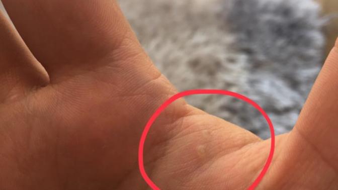 Elimde sürekli çıkan bu şey nedir? Bilen yazarsa sevinirim?
