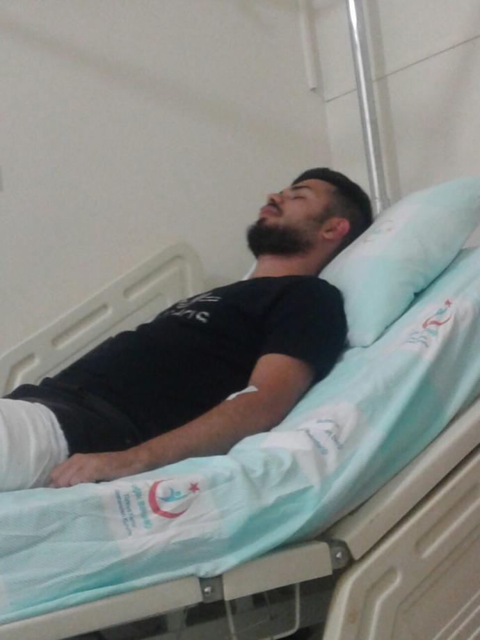 Ayak bileğimi kırıldı ameliyat oldum?