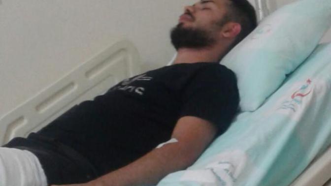 Ayak bileğimi kırıldı ameliyat oldum?
