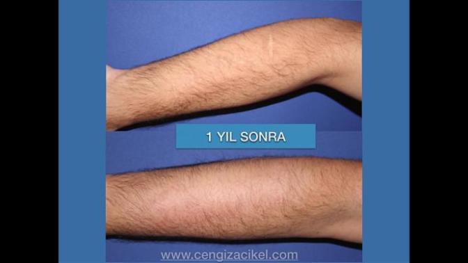Pomem icin yardim ?
