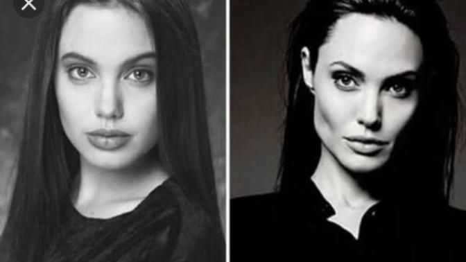 Yüz inceltme ameliyatı olanlar?