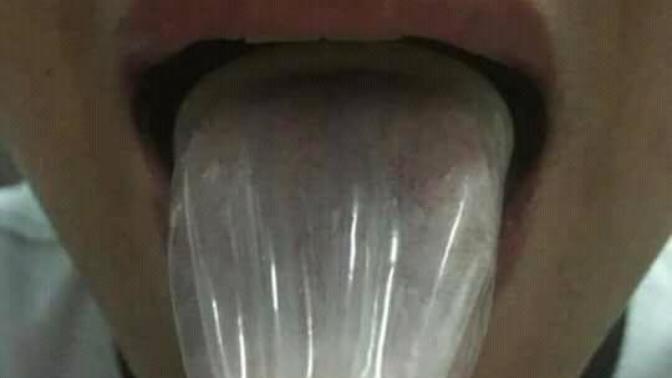 Condom ile oral seks olurmu?
