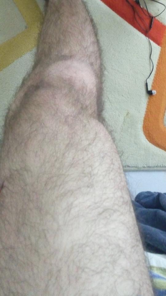 İki ucu boklu değnek tutmuş gibiyim, ne yapayım şimdi arkadaşlar?