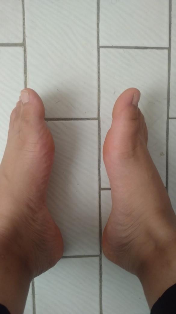 Ayaklarım düz taban mı kilodan mı?