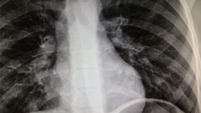 Akciğer filmini yorumlayacak doktor arkadaş var mi?