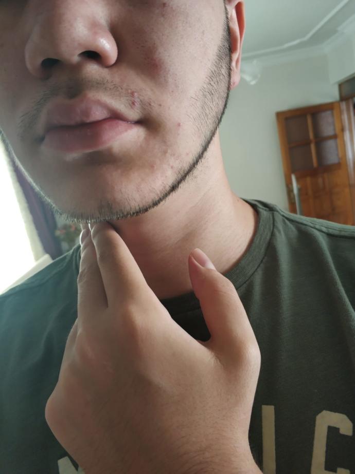 Cildimdeki gözenekler için ne yapmalıyım?