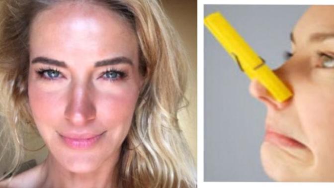 Burcu Esmersoy, burnu küçülsün diye 1 yıl burnunda mandalla uyumuş! Sizce çektiği eziyete değmiş mi?
