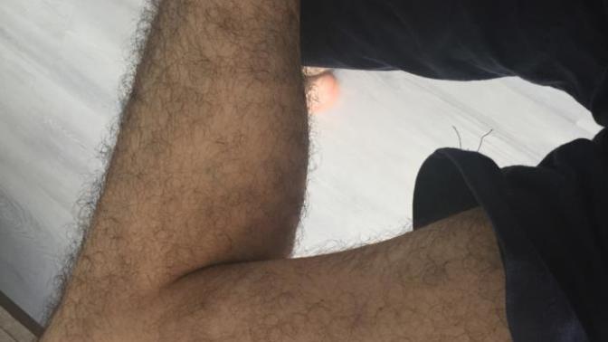 Bacaklarım da ki kılları almalı mıyım?