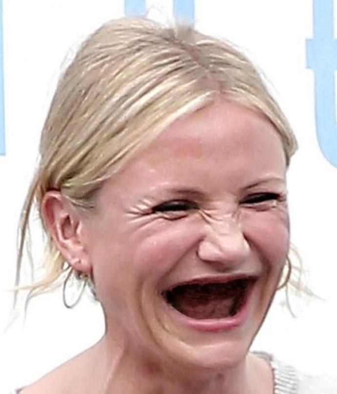 Hollywood güzellerinin dişsiz halleri! Tanıdığınız ve yakından takip ettiğiniz ünlülerin dişleri olmasaydı nasıl görünürlerdi?