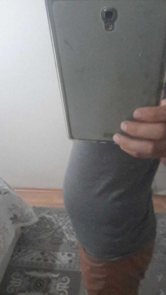 Kızlar göbegim böyle aniden çıkıyor, bu ne yardımmm?