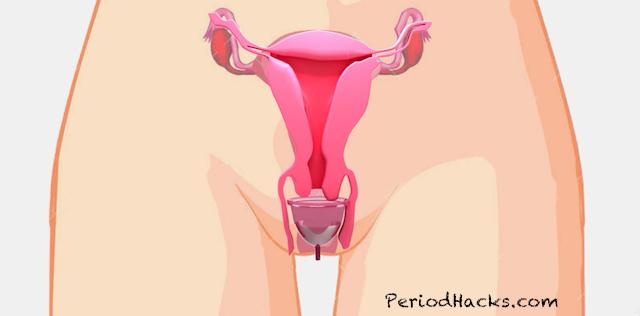 Kızlar, Menstrual Kap / Adet Kabını kullanan var mı? bunu içinizde mi taşıyorsunuz? Amuda kalktığınızda ne oluyor :)? Resimli?