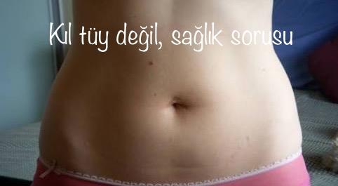 Kıl tüy sorularından gına geldi.