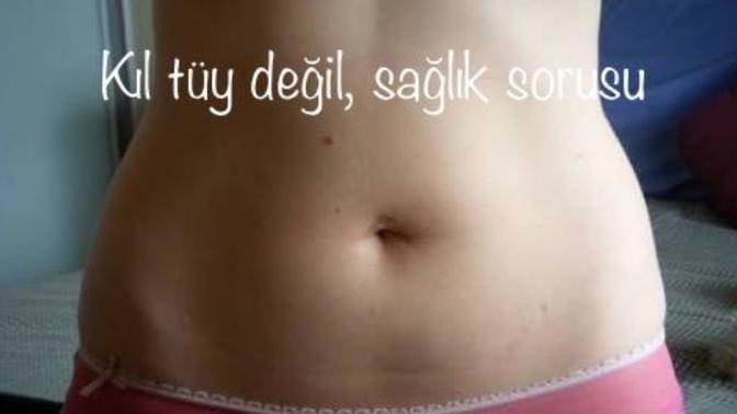 Kıl dönmesi ameliyatı olan var mı ve karın kasları olan göbekte kıl dönmesi olur mu?