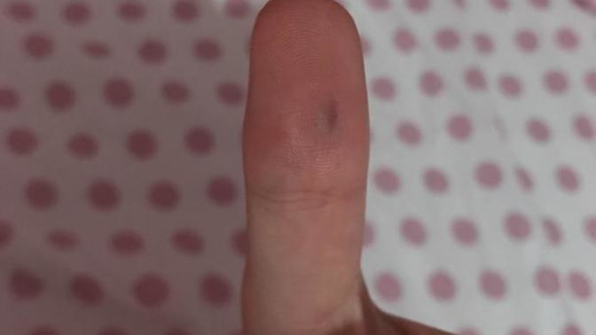 Elim paslı Demir’e sıkıştı bir şey olur mu?