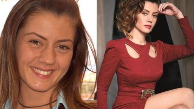 Yüzünde veya vücudunda estetik bulunmayan ünlü kalmış mıdır?