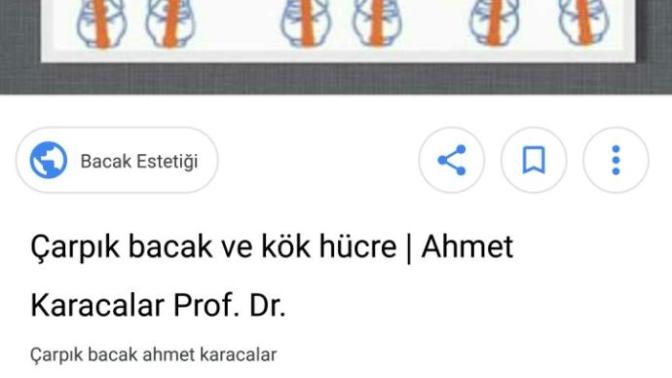 Çarpık bacak nasıl düzelir?