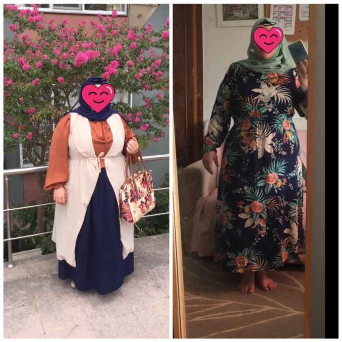42 kilo verdim, belli oluyor mu?