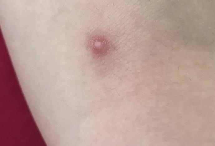 Doktor falan var mi? Arkadaslar kolumda bu var bu ne?