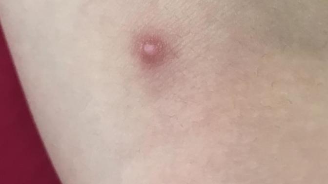 Doktor falan var mi? Arkadaslar kolumda bu var bu ne?