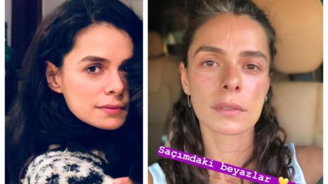 Özge Özpirinçci, saçındaki beyazlarını paylaştı! Sizce doğallık işini biraz abarttı mı?