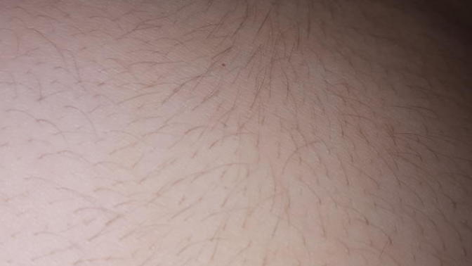 Kızlar, Göğüs ve karın bölgemdeki bu sık tüylerden nasıl kurtulabilirim 😭 ?