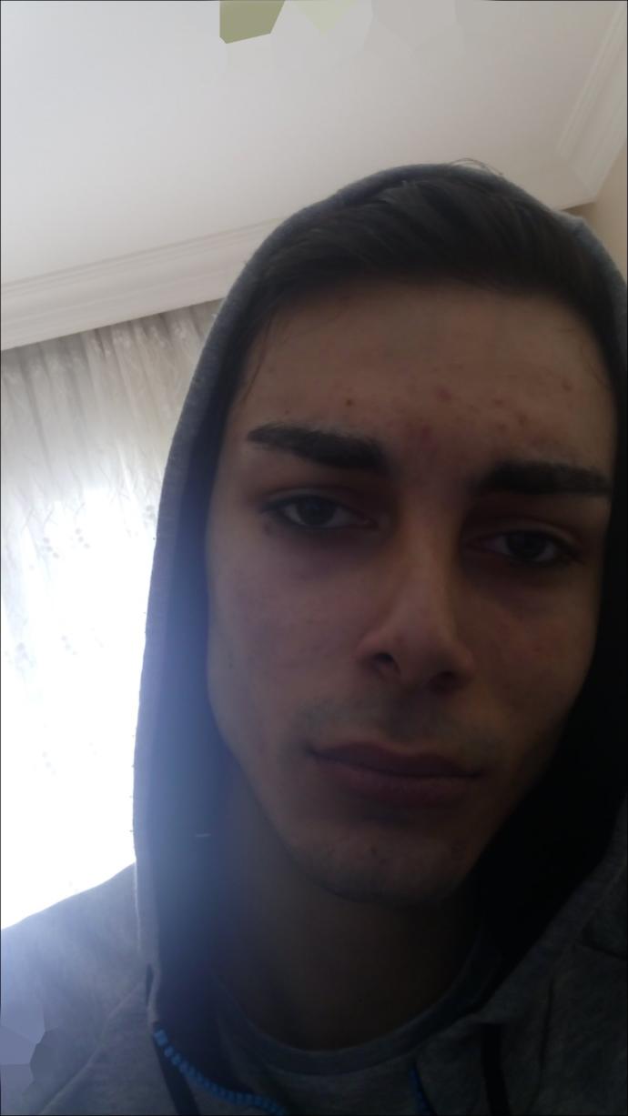 Sizce yüzüm çokmu zayıf?