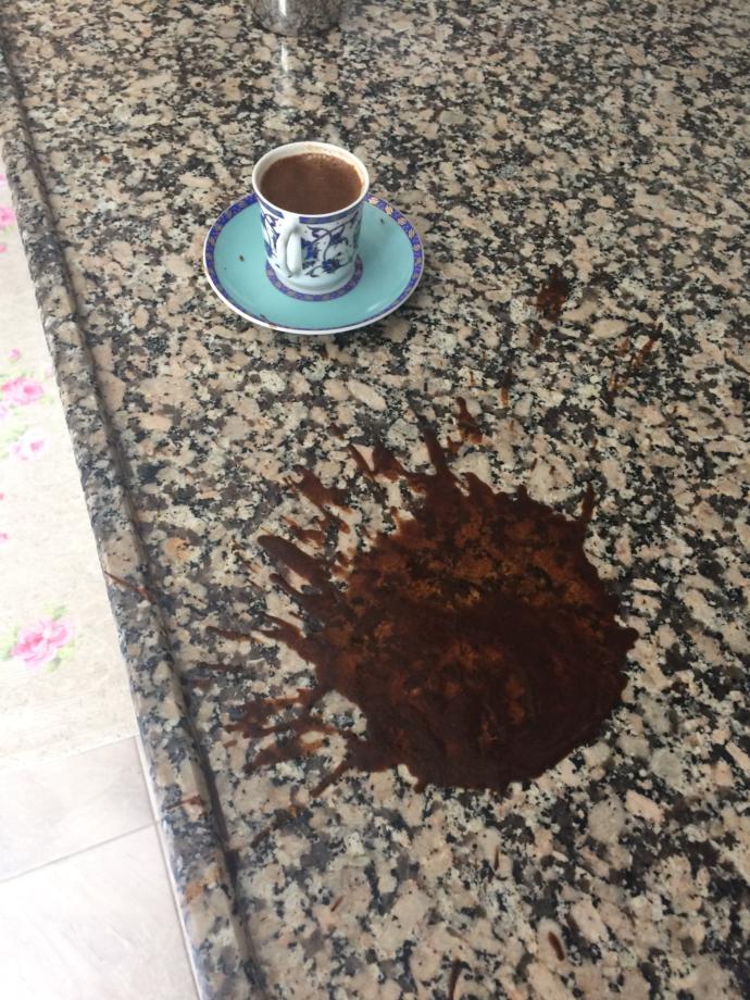 Sizce bu nazar mı yoksa beceriksizliğim mi?