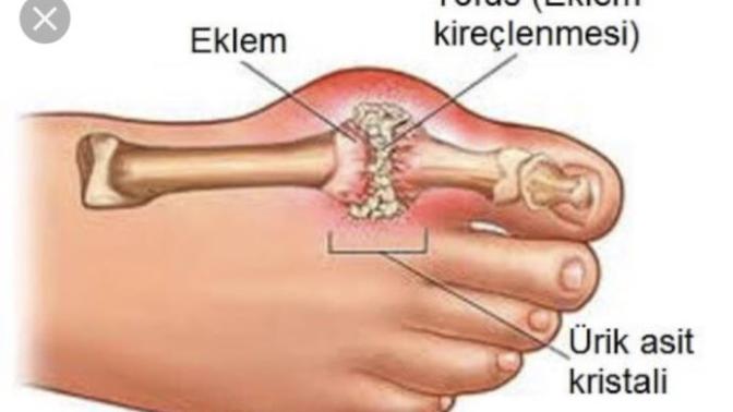 Gut hastası olan varmı?