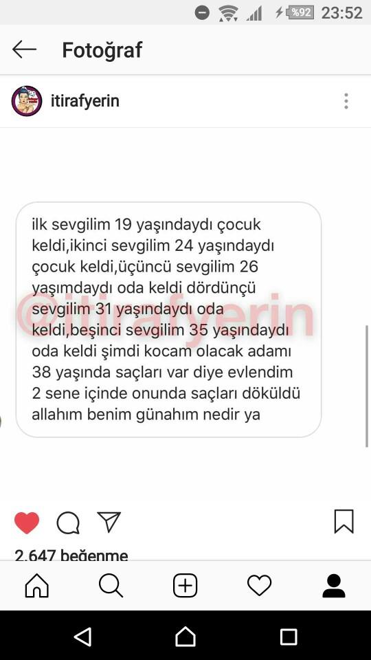 Kel erkekleri çekici buluyor musunuz, bazı erkeklere yakışıyor mu?