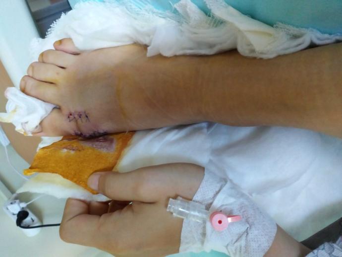 Halluks valgus ameliyatı olanları tekrar buraya alabilir miyim?