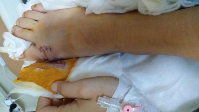 Halluks valgus ameliyatı olanları tekrar buraya alabilir miyim?
