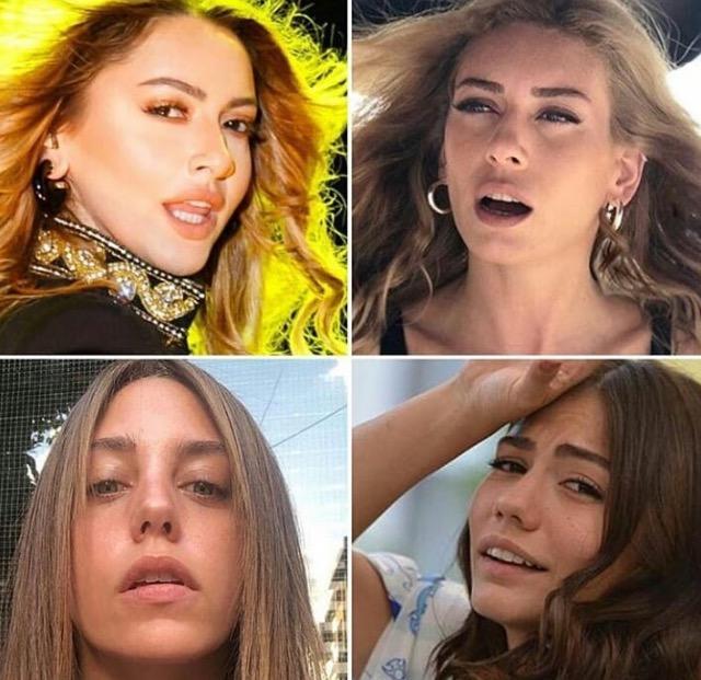 Ağzı açık poz verme akımında favori ünlünüz hangisi?
