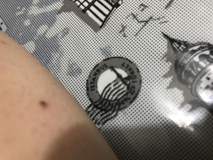 Lazere gittim benede vurdular benimi tırnakla ovdum koyu renki kabugu kalktı altta açık rengi kaldı zararlımı acaba?