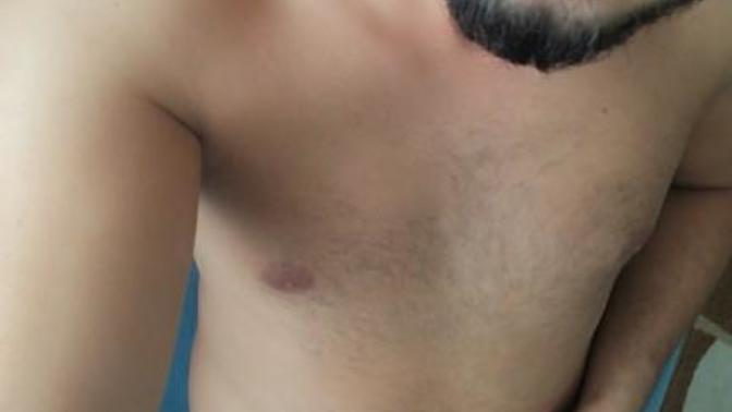 Tatile hazırlık olarak gögüs kıllarını almalımıyım sizce?