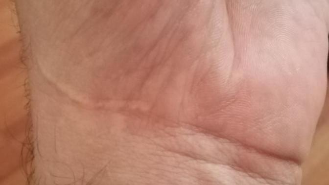 Vücudunuz'da kesik, yara, dikiş izleri varmı?